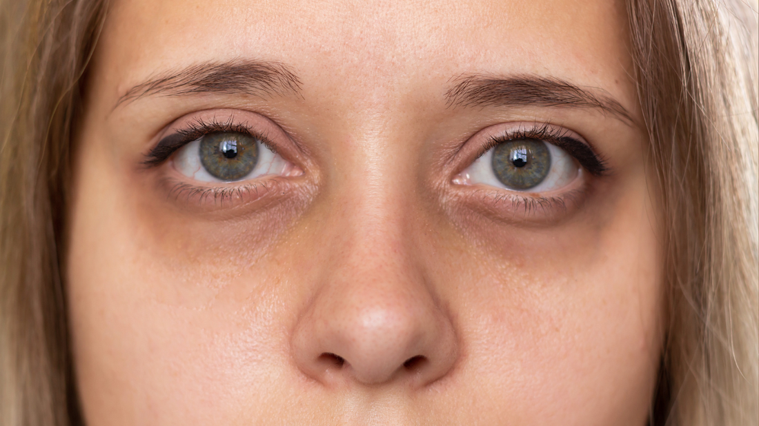 Hydration is the Key to Youthful Eyes: Why You Need a Moisturizing Eye Cream