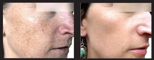 Why Your Skin Looks Dull – The Hidden Causes & How to Fix It Fast