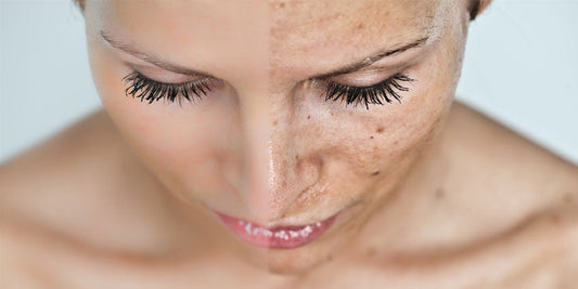 The Ultimate Guide to Reversing Sun Damage – What Really Works?